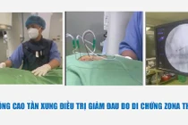 Đốt sóng cao tần 6 phút hết đau ngực vì di chứng Zona thần kinh?
