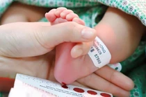 13 phút có 1 trẻ chào đời bị bệnh di truyền: cần sàng lọc sau sinh
