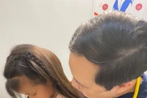 Bác sĩ chỉ rõ trường hợp chảy máu cam cần đến viện gấp