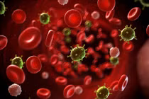 Bác sĩ chỉ rõ những dấu hiệu cảnh báo ung thư máu