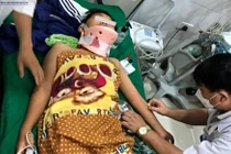 Nhiều trẻ nhỏ bị tai nạn nghiêm trọng từ xe đạp, xe máy điện