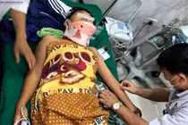 Nhiều trẻ nhỏ bị tai nạn nghiêm trọng từ xe đạp, xe máy điện