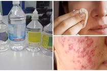 Rửa mặt nước muối có an toàn cho da?