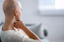 Chuyên gia mách cách chăm sóc tóc rụng ở bệnh nhân ung thư