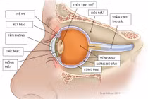 Cách điều trị ung thư mắt