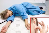 Dấu hiệu cơ thể cảnh báo đột quỵ trước 1 năm, cần biết để cứu mình