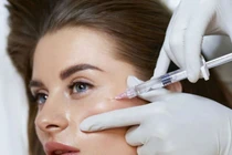 Hỏng mặt sau tiêm meso căng trắng da, đâu là nguyên nhân?
