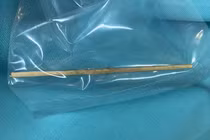 Tăm tre 10 cm đâm thủng đại tràng