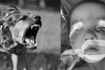 Trẻ 3 tuổi bị chó cắn rách mặt: 100% không tiêm phòng dại sẽ chết