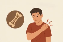 Vì sao người trẻ khoẻ cũng có nguy cơ loãng xương?