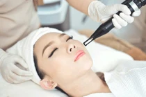 Công nghệ laser trong điều trị sẹo rỗ, nám da