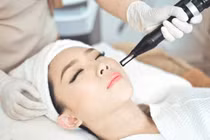 Công nghệ laser trong điều trị sẹo rỗ, nám da