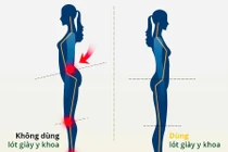 Chọn giày dép đúng cách tránh bệnh cột sống