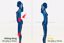 Chọn giày dép đúng cách tránh bệnh cột sống