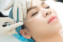 Có nên tiêm filler và botox làm đẹp?