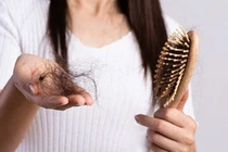 Tóc rụng hàng loạt vì dùng sai dầu gội