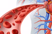 Đối tượng dễ mắc chứng bệnh cục máu đông 