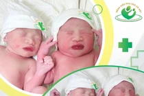 Hy hữu sinh đôi hiếm gặp: Một bé chào đời trong "bọc điều"