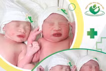 Hy hữu sinh đôi hiếm gặp: Một bé chào đời trong "bọc điều"