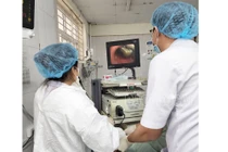 Gắp đỉa sống trong khí quản bệnh nhân 1 tháng