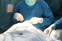 TP Hồ Chí Minh: Nhiều hộ kinh doanh thực hiện phẫu thuật thẩm mỹ không phép