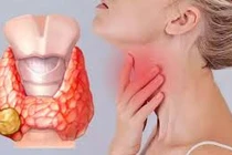 Rối loạn tuyến giáp có ảnh hưởng đến nguy cơ ung thư phụ khoa?