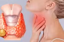 Rối loạn tuyến giáp có ảnh hưởng đến nguy cơ ung thư phụ khoa?