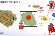 Hội chứng tiêu khối u đe dọa tính mạng người bệnh