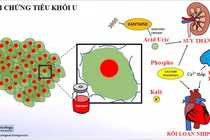 Hội chứng tiêu khối u đe dọa tính mạng người bệnh