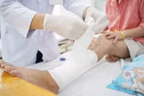 Trong khuôn khổ hợp tác nghiên cứu giữa bệnh viện Chợ Rẫy và Viện CSIRO (Úc) 2 bên đã thống nhất tiến hành thiết kế và in mảnh ghép cá thể hoá sản để điều trị cho bệnh nhân bị mất một đoạn xương dài do gẫy hở nhiễm trùng.