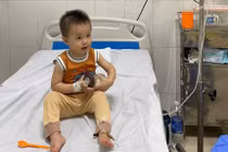 Uống phải dầu hỏa trẻ 20 tháng tuổi suy hô hấp