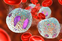 Lơ xê mi kinh dòng bạch cầu hạt