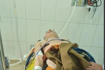 Suy đa tạng, tổn thương não vì sốc nhiệt: Xử trí ban đầu thế nào?