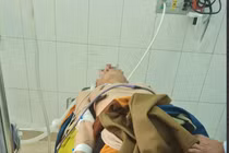 Suy đa tạng, tổn thương não vì sốc nhiệt: Xử trí ban đầu thế nào?