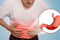 Bác sĩ chỉ rõ thói quen khiến chữa dạ dày mãi không khỏi