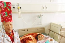 Bé 3 tuổi bị bỏng khắp người do lửa cháy