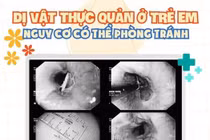 Dị vật thực quản trẻ em: Nguy hiểm có thể phòng tránh