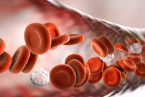 Cách khắc phục thiếu máu khi điều trị ung thư cho sức khỏe tốt