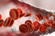 Cách khắc phục thiếu máu khi điều trị ung thư cho sức khỏe tốt