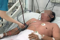 Suy hô hấp cấp do mắc sởi