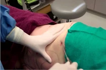 Hút mỡ bụng bị tử vong: HCM chỉ đạo các hoạt động an toàn thẩm mỹ