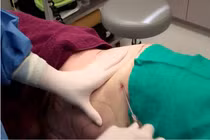 Hút mỡ bụng bị tử vong: HCM chỉ đạo các hoạt động an toàn thẩm mỹ