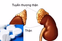 Suy thượng thận do thuốc Corticoid có thể chữa khỏi không?