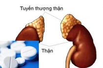 Suy thượng thận do thuốc Corticoid có thể chữa khỏi không?