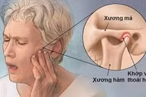Địa chỉ vàng: Nơi khám chữa viêm khớp thái dương hàm tốt