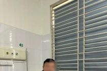 Hay ăn đồ tái sống, người đàn ông mắc sán dây 10m