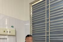 Hay ăn đồ tái sống, người đàn ông mắc sán dây 10m