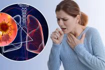 84% số ca tử vong tại Việt Nam do bệnh không lây nhiễm