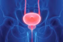 Yếu tố nguy cơ, cách phòng tránh ung thư bàng quang