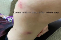 Nhiều người bị những bệnh lý hay gặp dễ nhầm lẫn với đau xương khớp